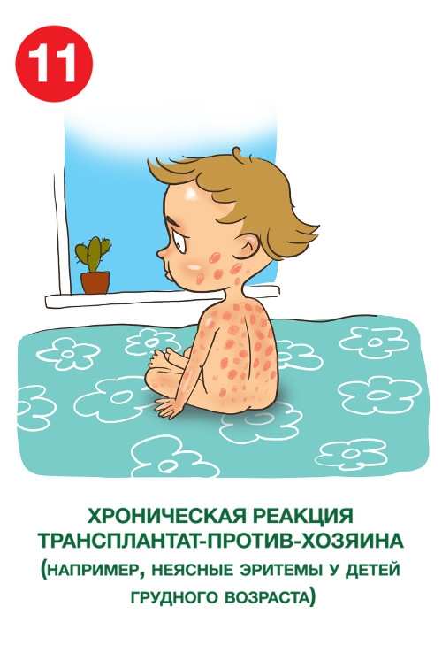 Нарушение иммунитета: проверь своего ребенка по этим 12 признакам Нарушение иммунитета: проверь своего ребенка по этим 12 признакам
